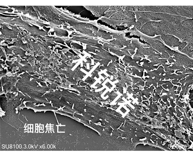 扫描电镜细胞焦亡